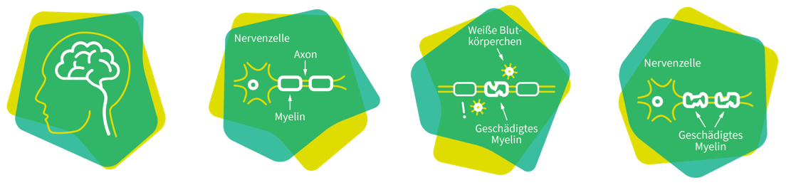MS und ich: Grafik „Zentrales Nervensystem“ MS und ich: Grafik „Zentrales Nervensystem“